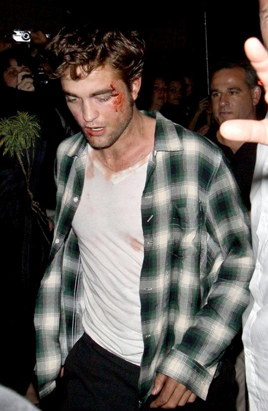 Robert Pattinson Bloody on Remember Me Set